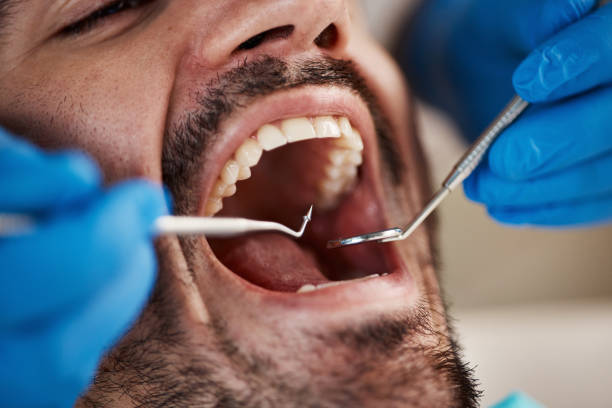 Best Cosmetic Emergency Dentistry in Rocky River, OH